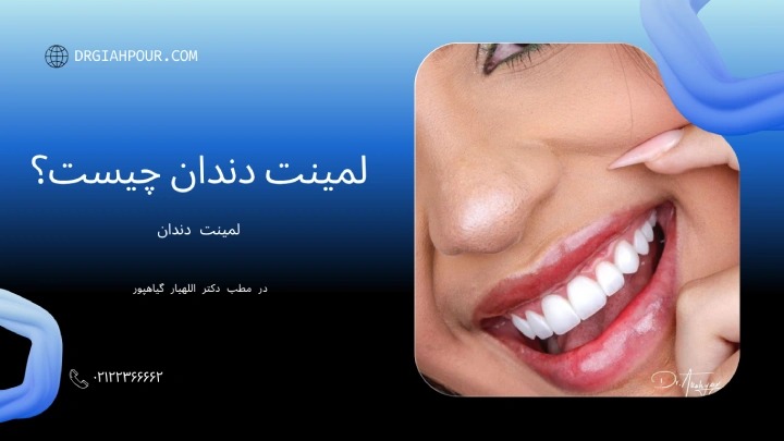 لمینت دندان